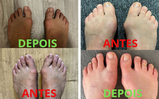 Fazer a transição do calçado convencional para o calçado Barefoot